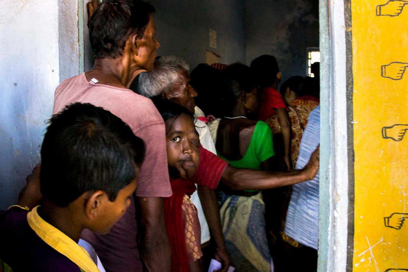 A child with facial tumour