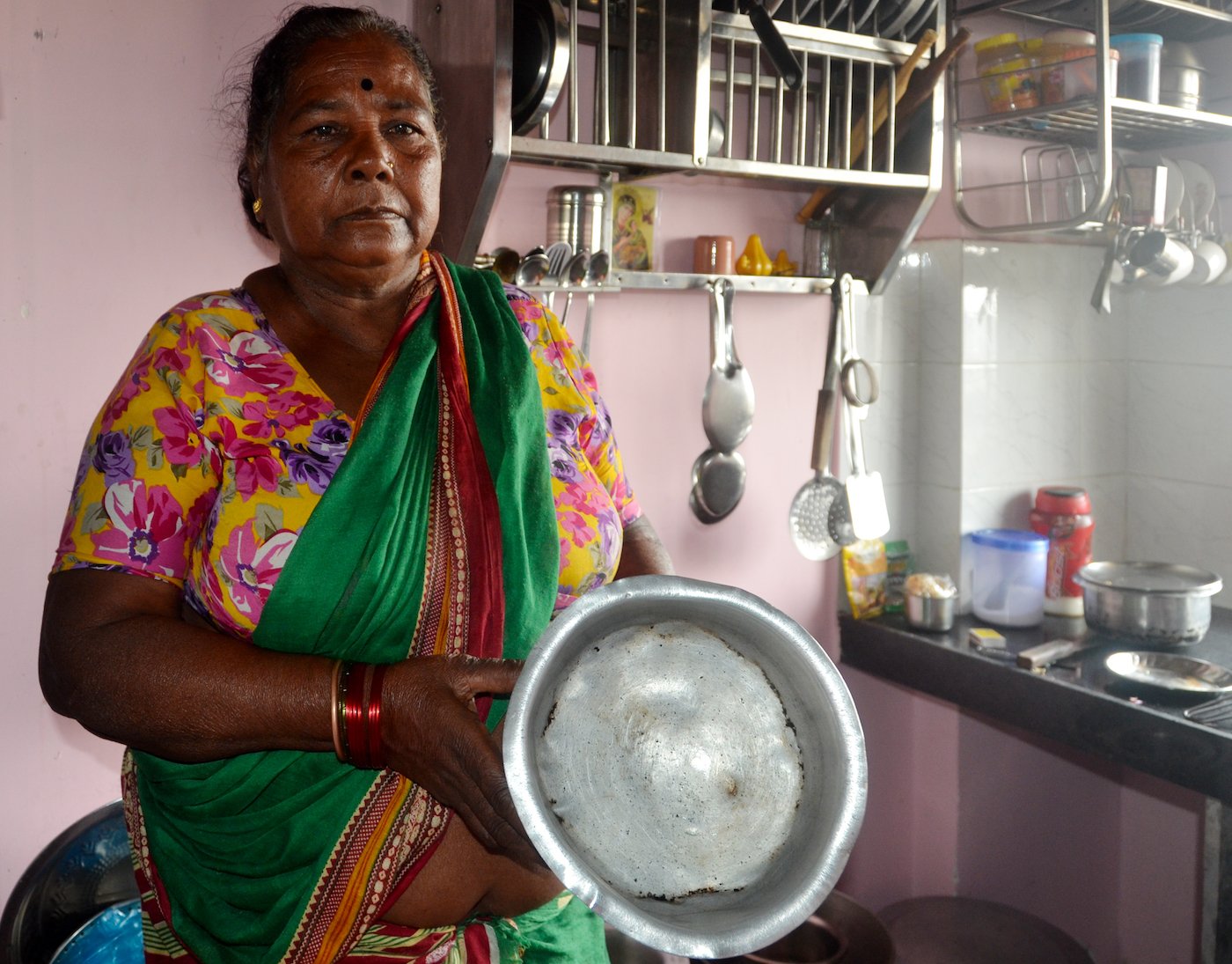 woman showing dented vessels